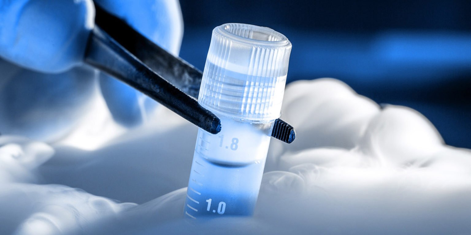 stem cell banking